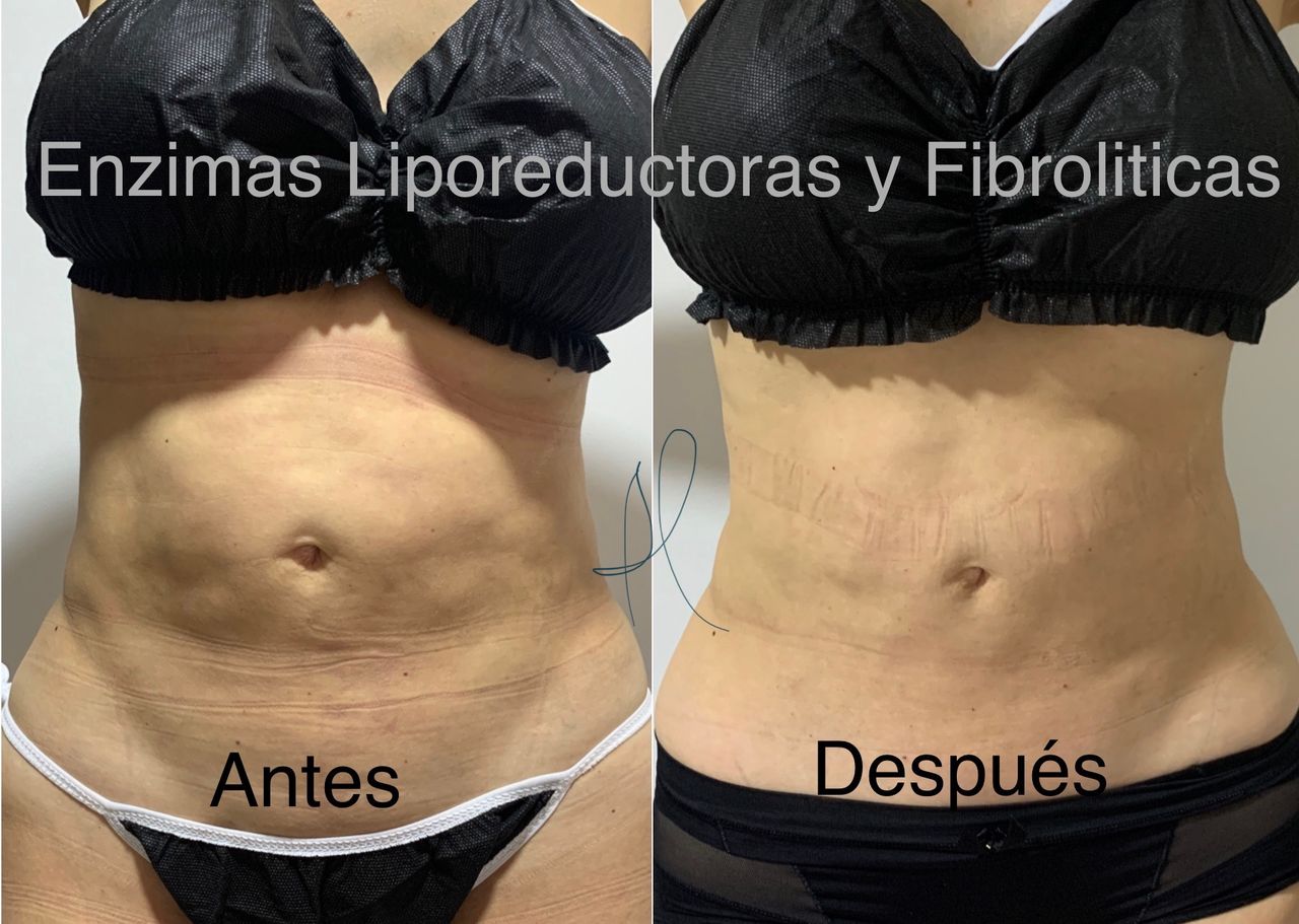 Maria Gisela Angel Losada-14