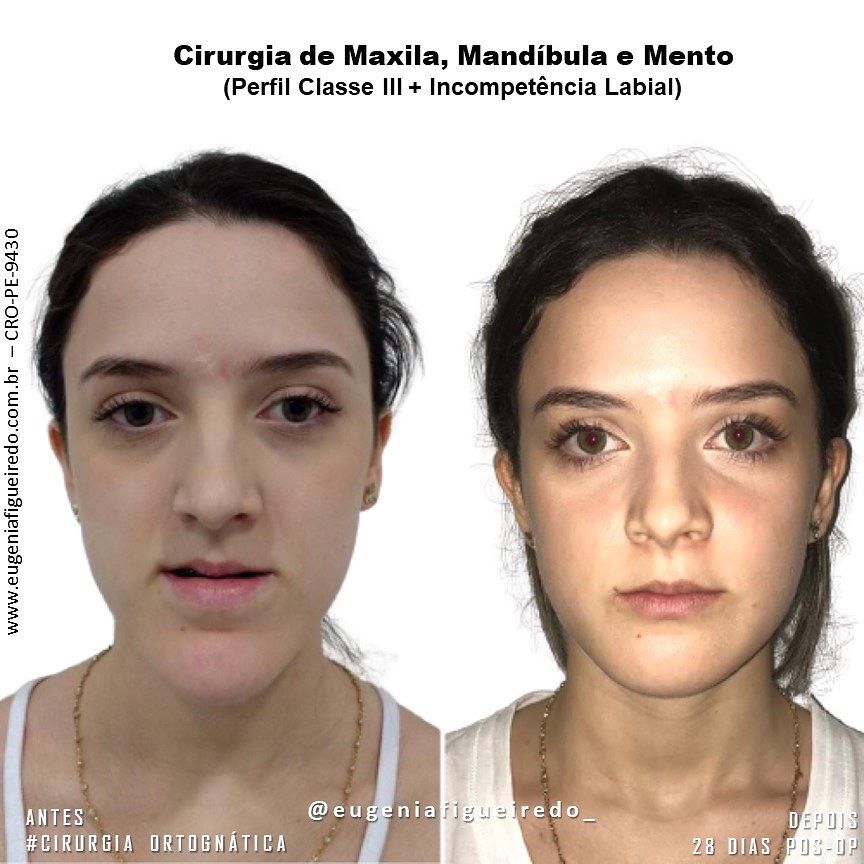Eugênia Figueiredo-12