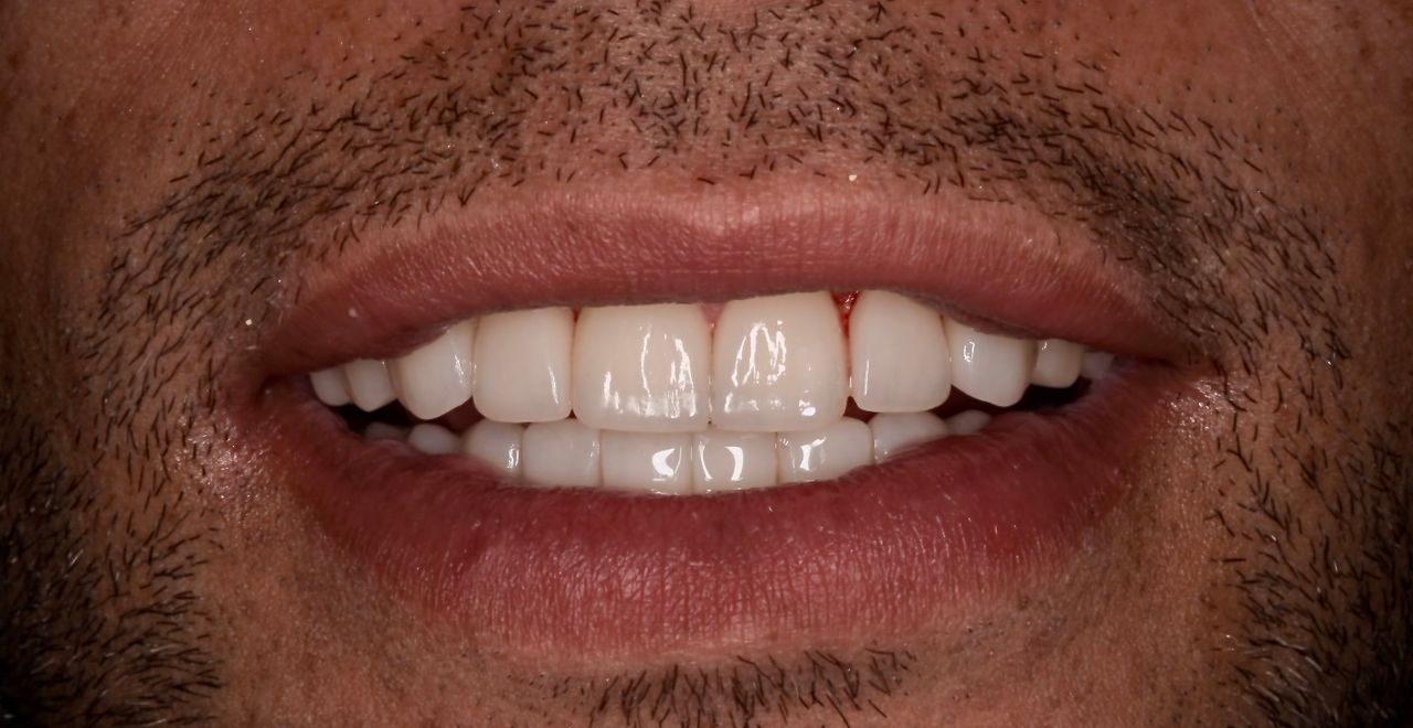 Carlos Mauricio Franco Cardona-10