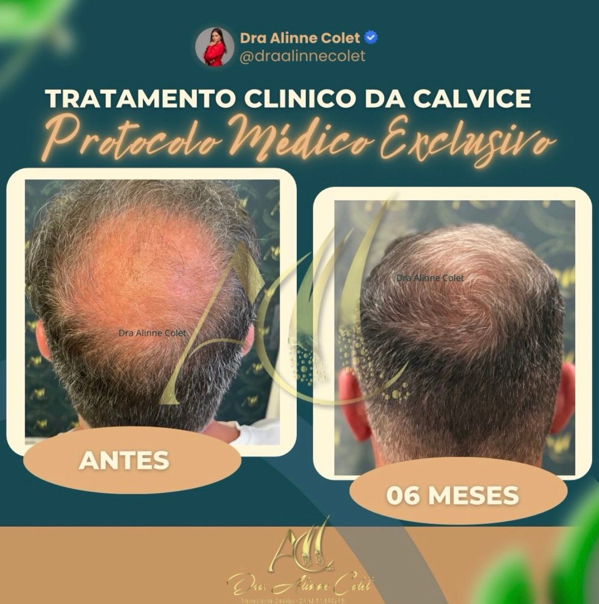 Alinne Gerssica Soares Colet-10