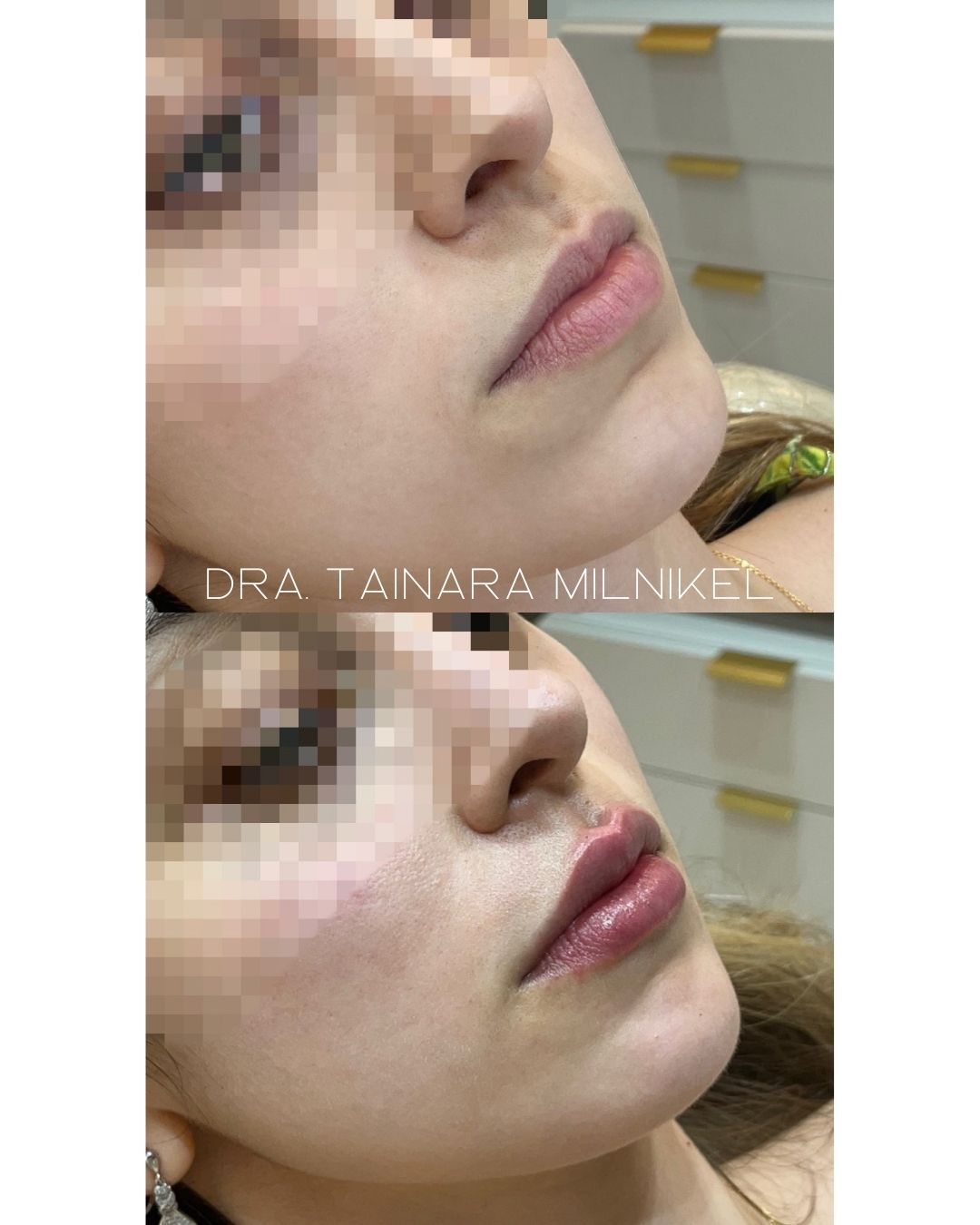 Tainara Rieger Milnikel-7