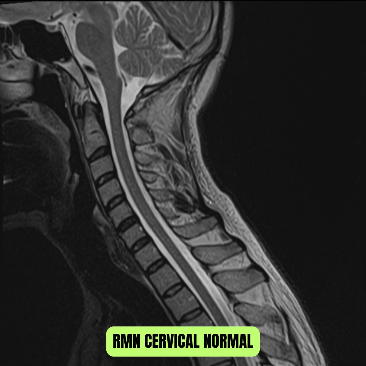 David Tafur Muñoz-1063