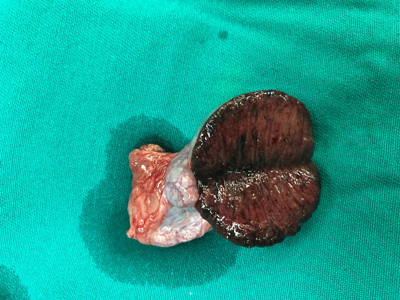 Raúl Federico Larcade-9