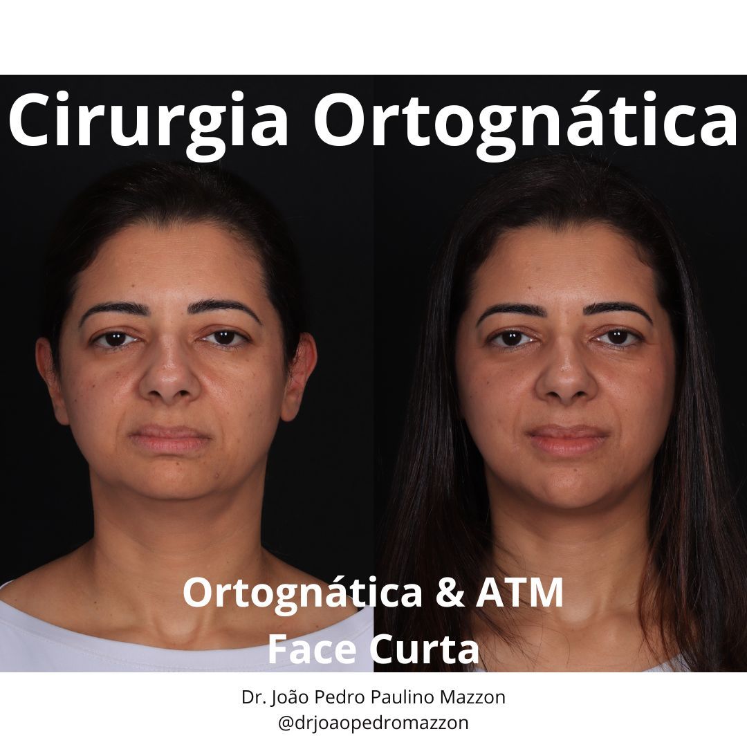 João Pedro Paulino Mazzon-4