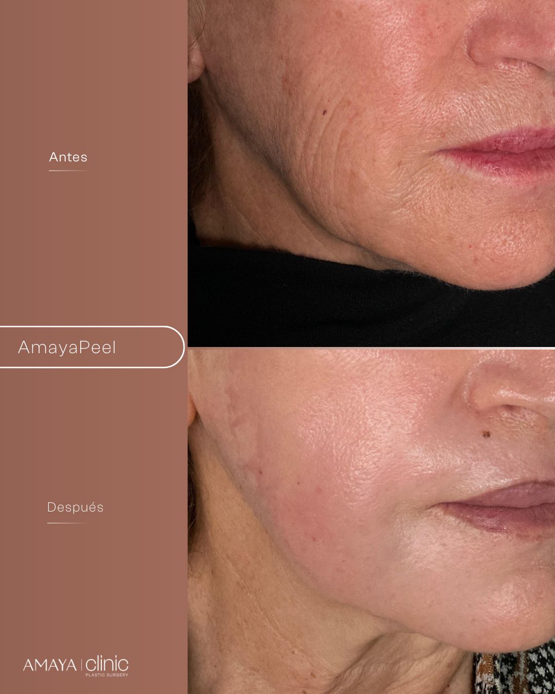 Felipe Amaya Espinosa-13