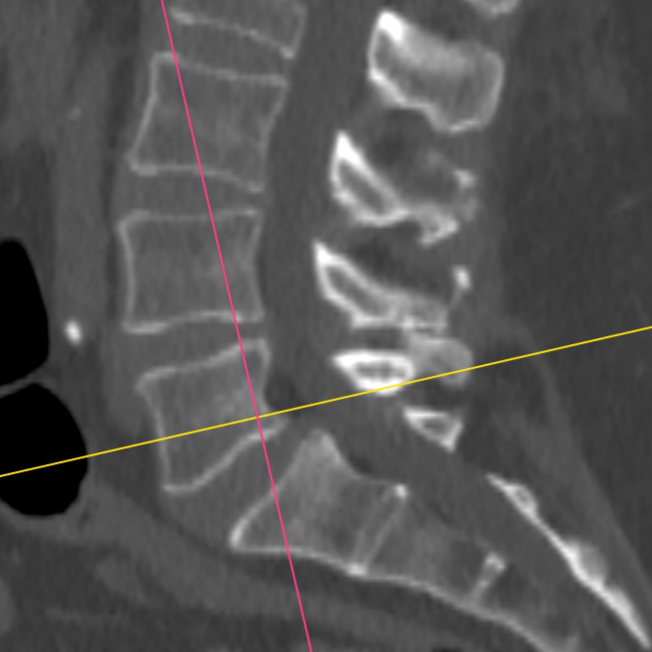 David Tafur Muñoz-2368