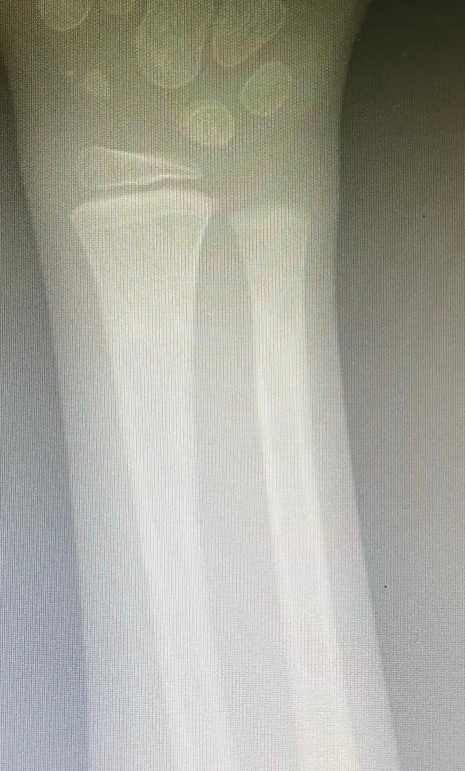 Jônatas Laurindo Giacomini-24