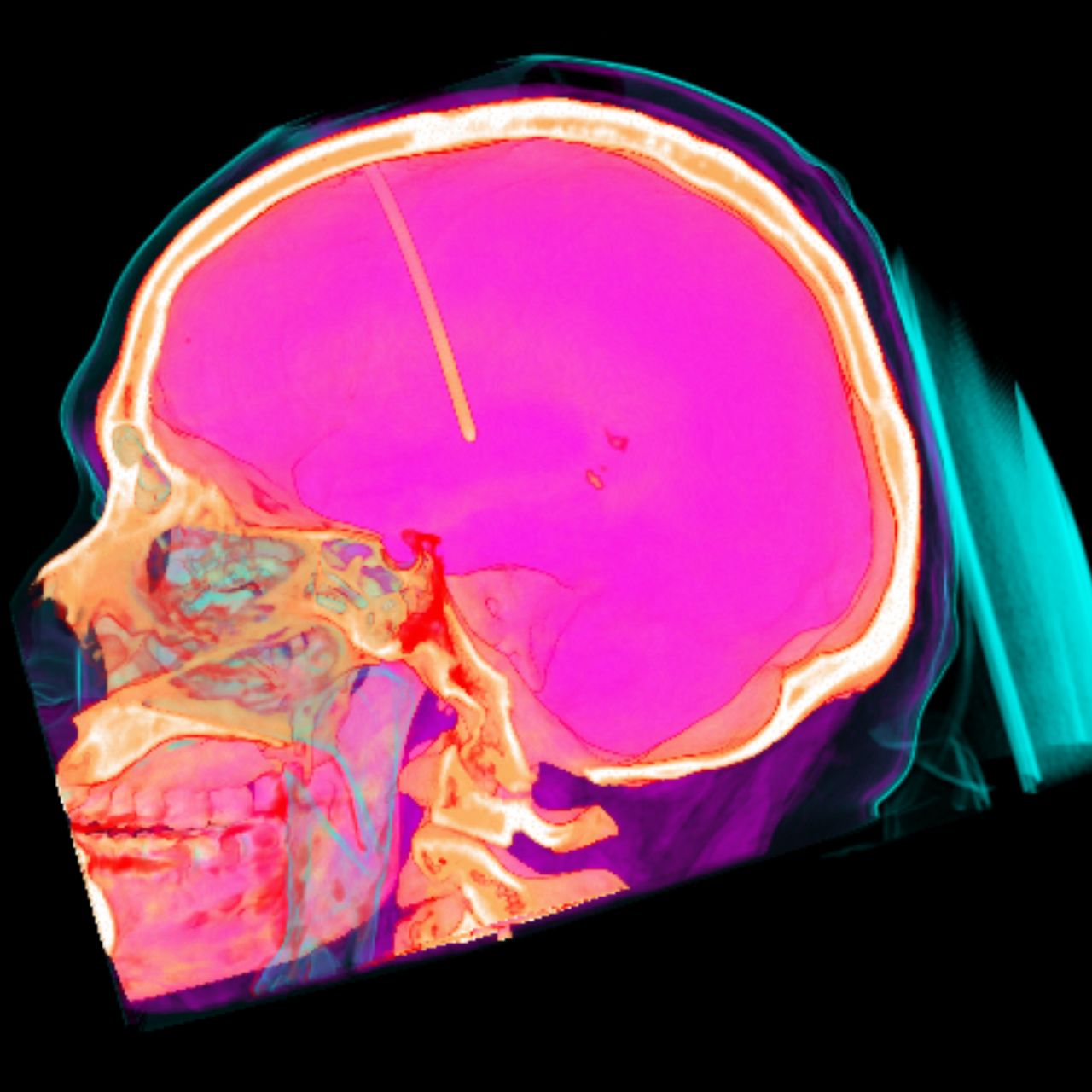 David Tafur Muñoz-2398