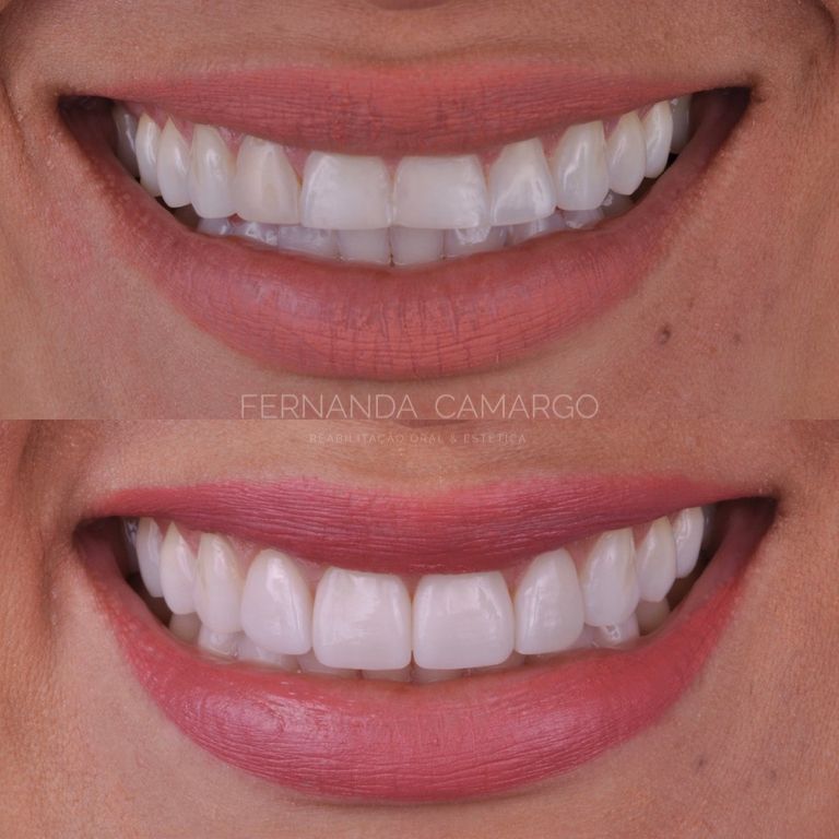 Fernanda Camargo Silveira-10