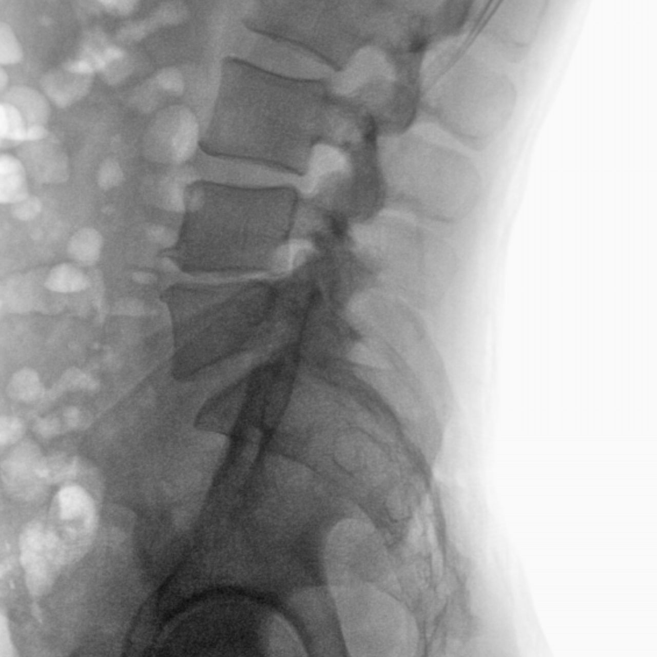 David Tafur Muñoz-1562