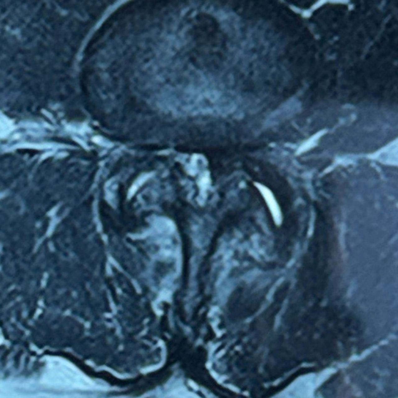 David Tafur Muñoz-2473