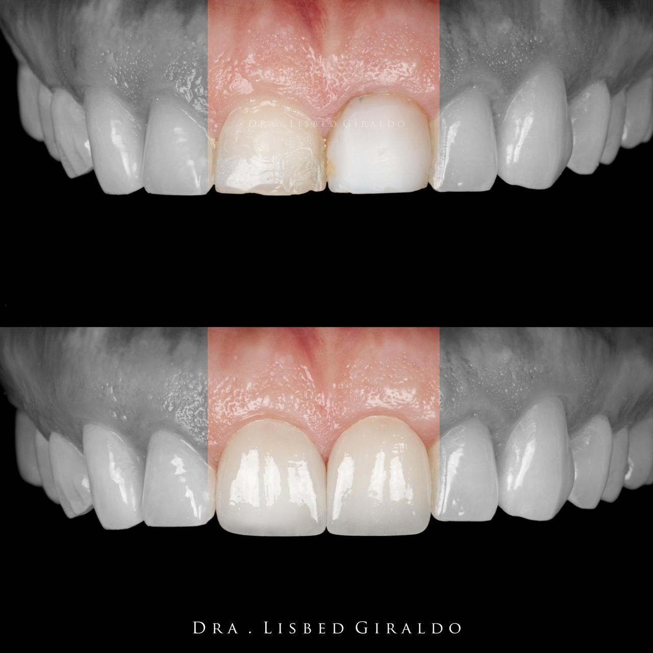 Lisbed Giraldo Olarte-32