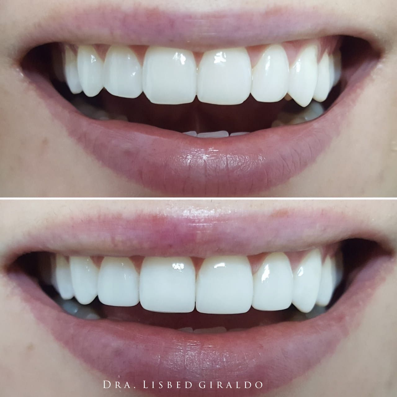 Lisbed Giraldo Olarte-11