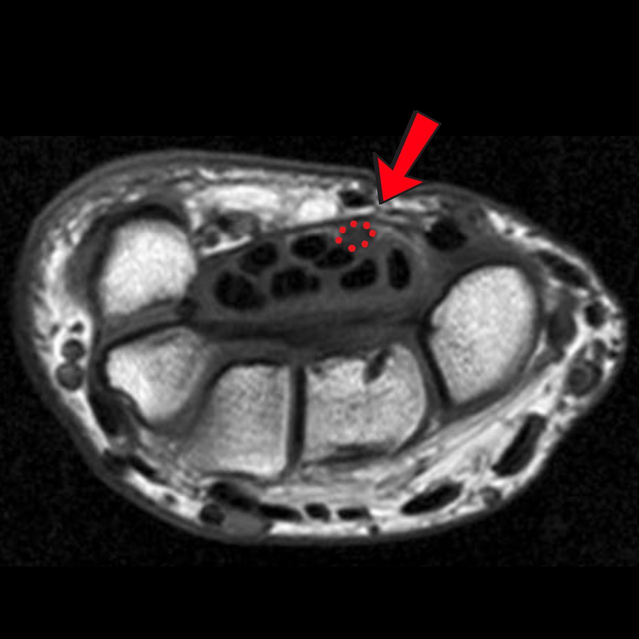 David Tafur Muñoz-1977