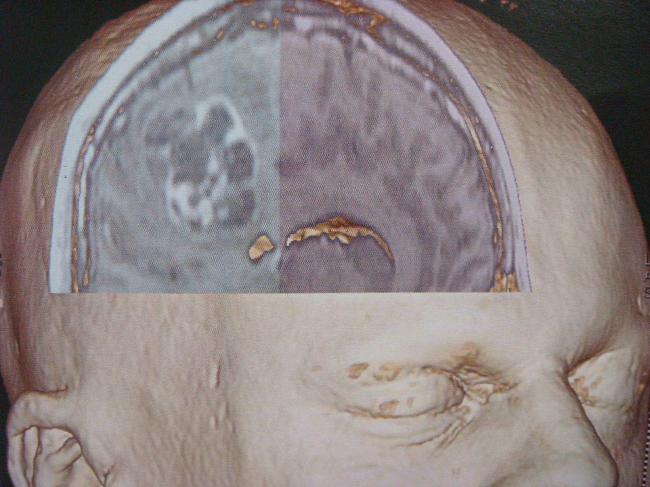 Leonardo Conrado Silva Lima-4