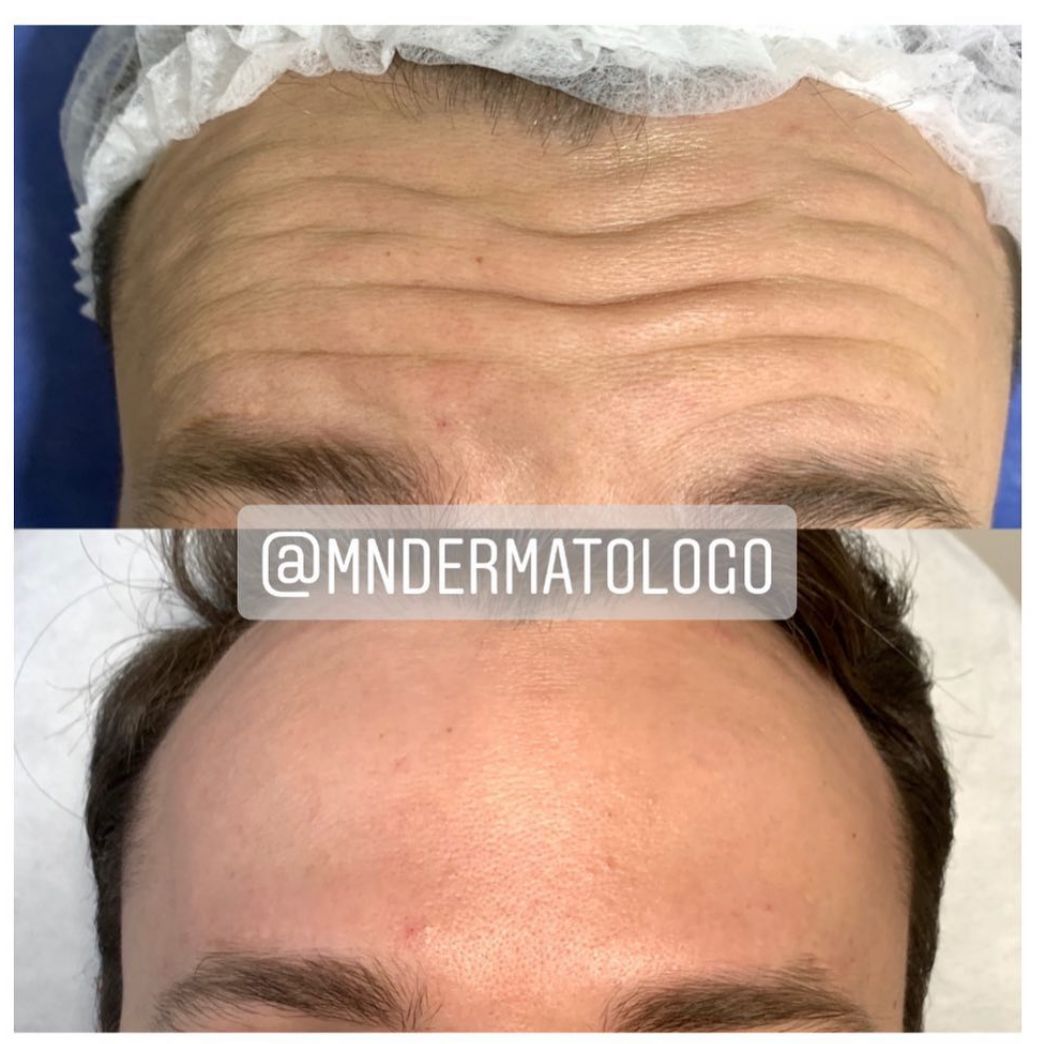 Mario Naranjo Otero-12