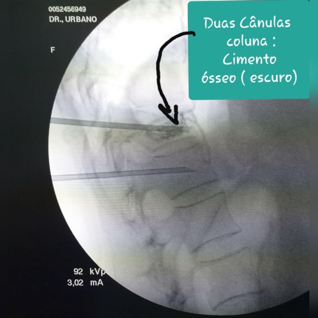 Urbano Chamadoiro-11