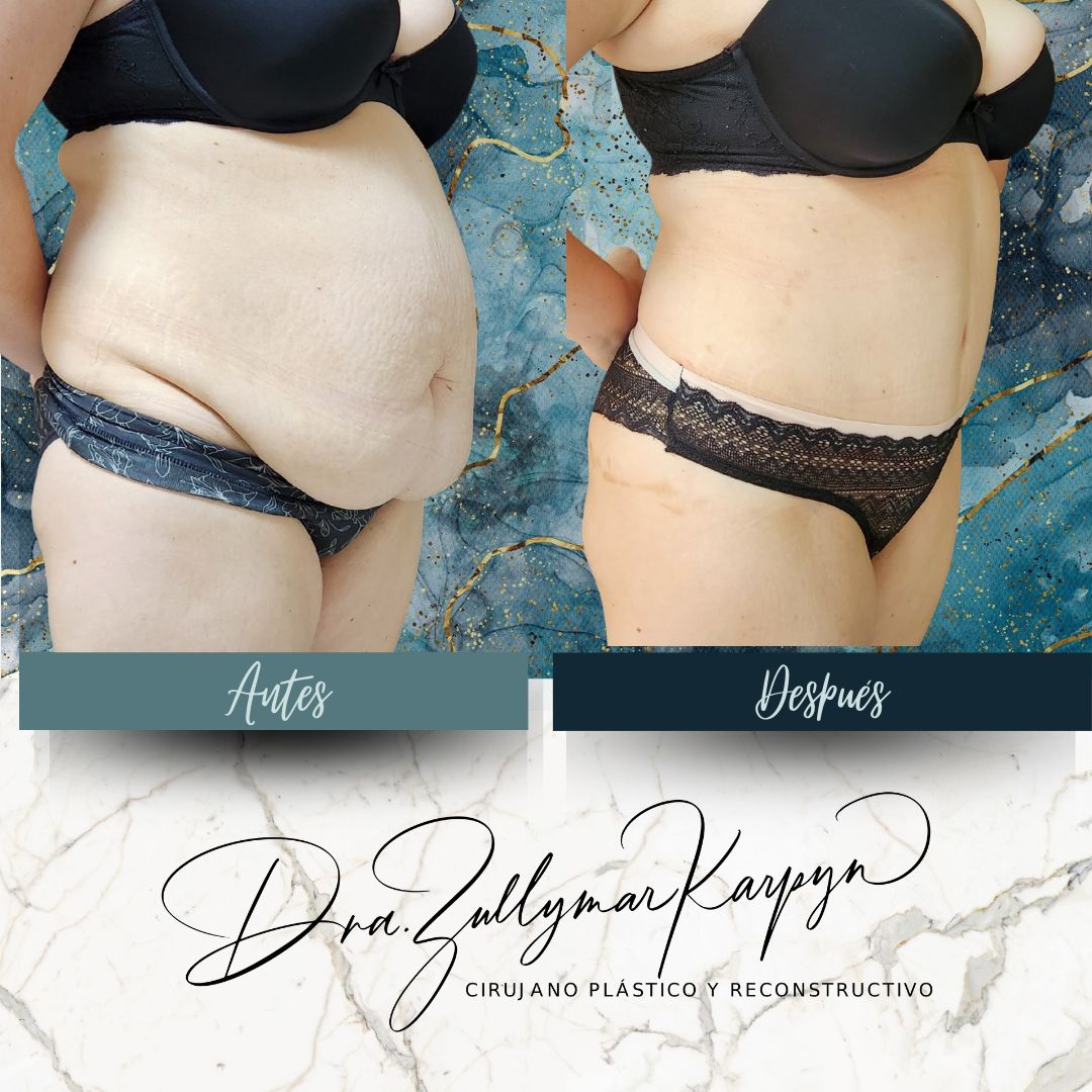 Zullymar Karpyn Brito-4