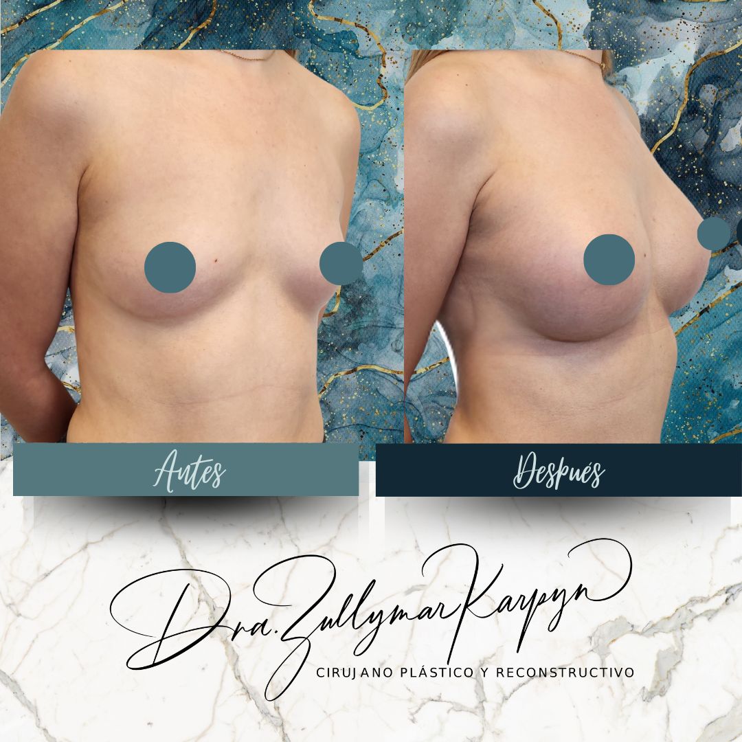 Zullymar Karpyn Brito-15