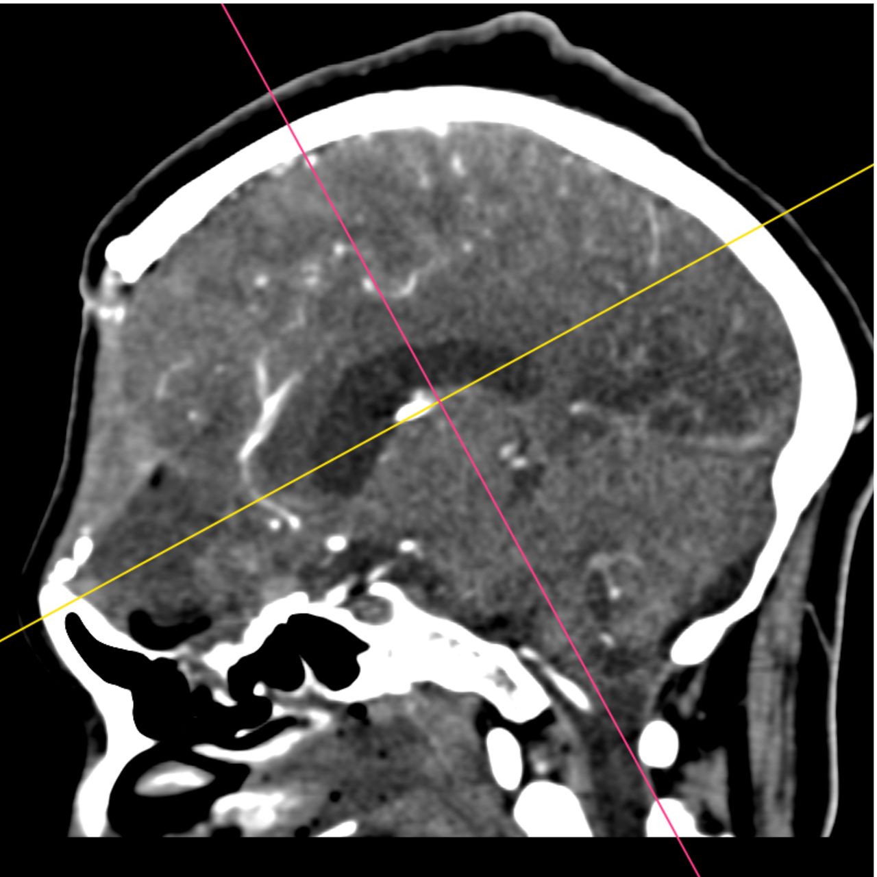 David Tafur Muñoz-1601