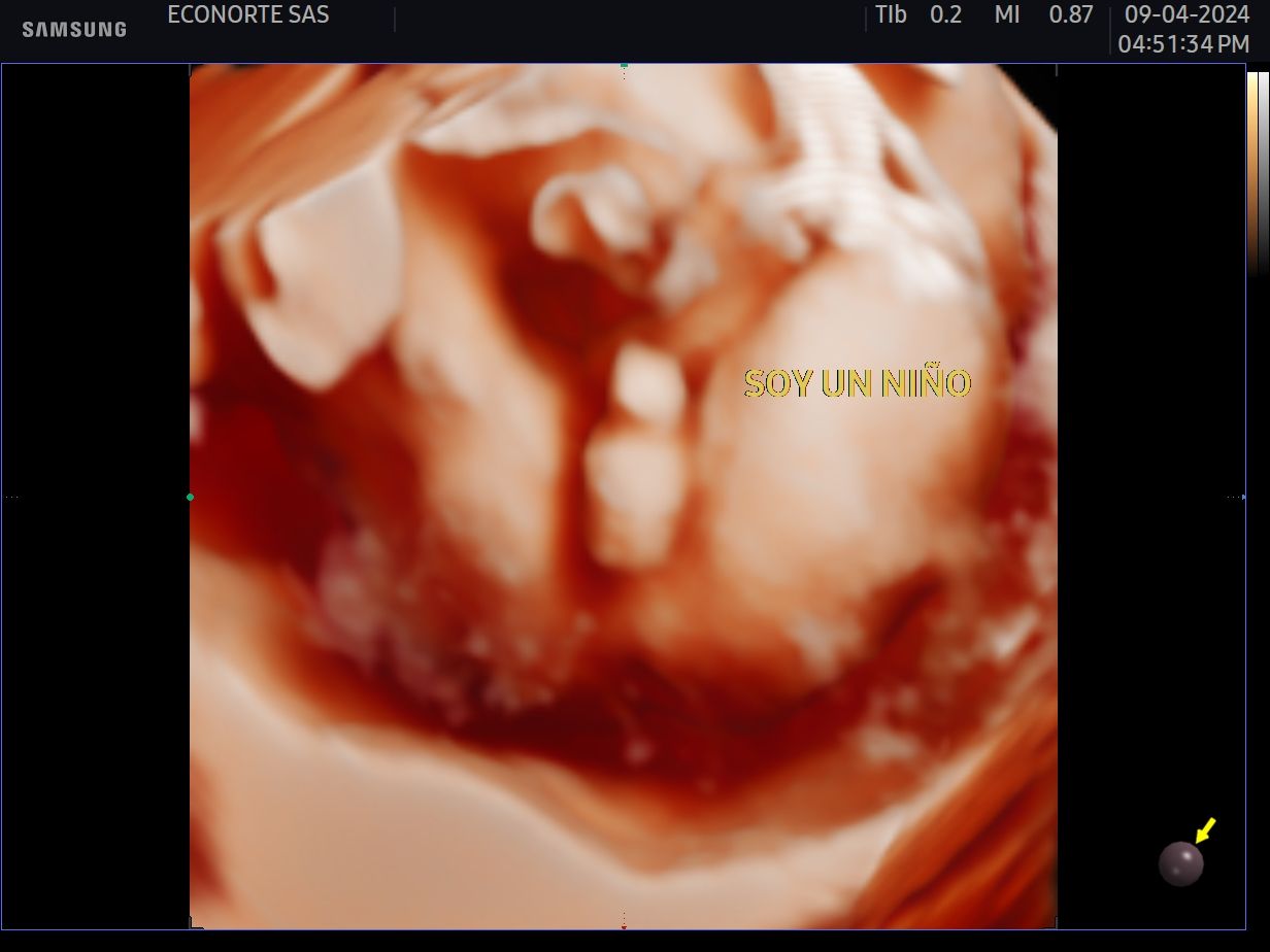 Blas Alberto Ahumada Castellanos-7