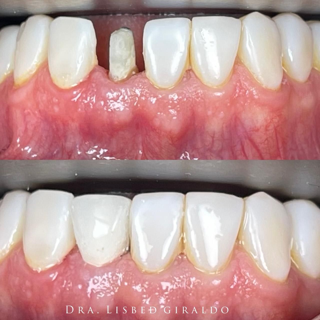 Lisbed Giraldo Olarte-25