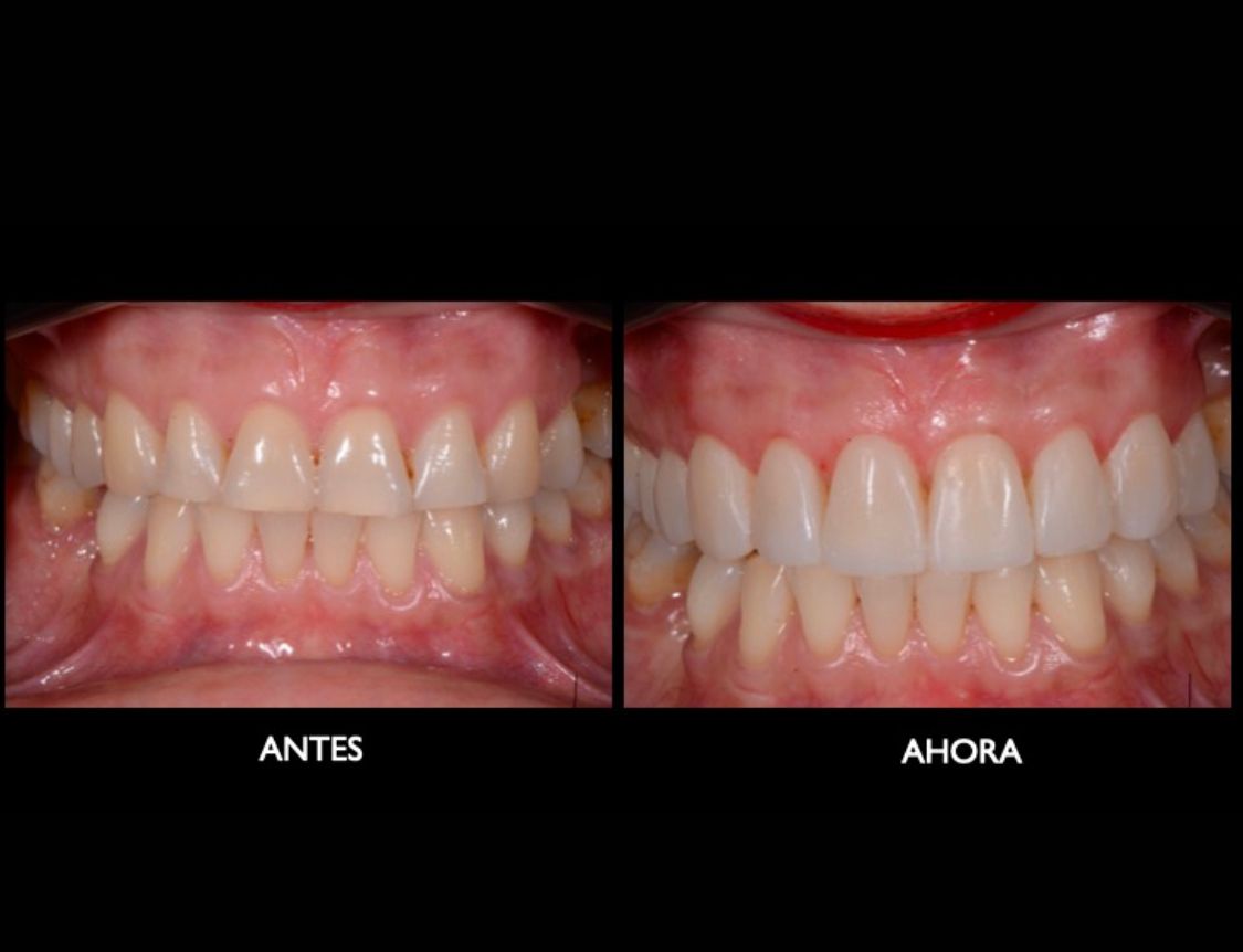 Melissa Vargas Castellanos-11