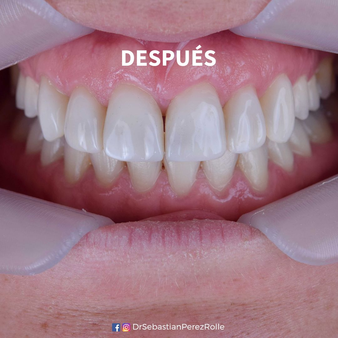 Sebastián Pérez Rolle-0