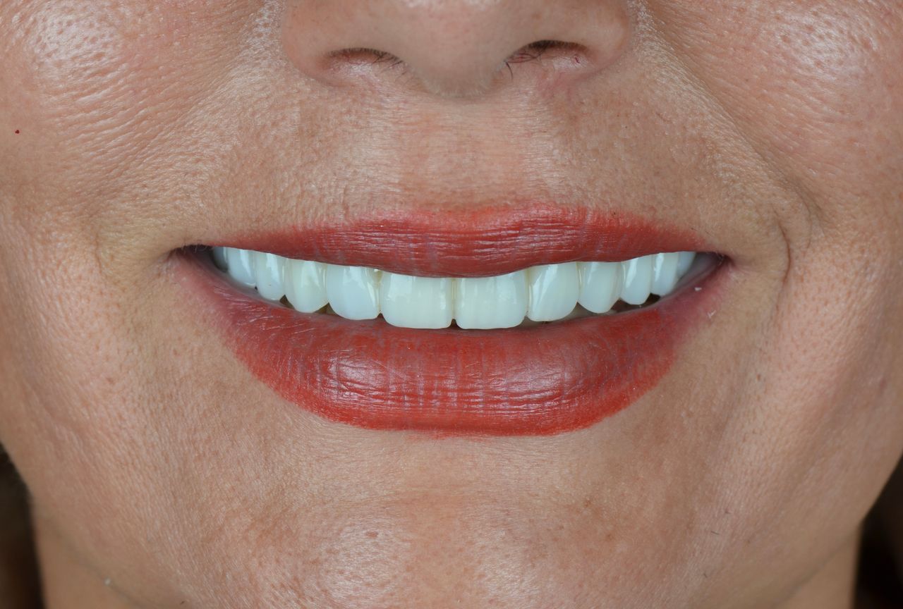 Luciano Varas Salinas-27