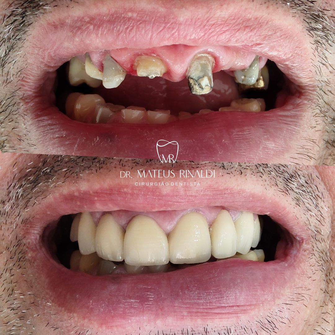 Mateus Rinaldi Lucio Martins-5