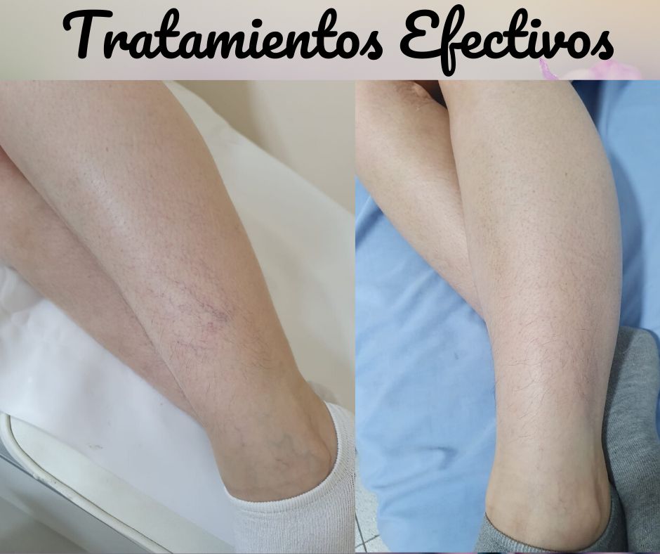 Cindy Vásquez Marzano-20