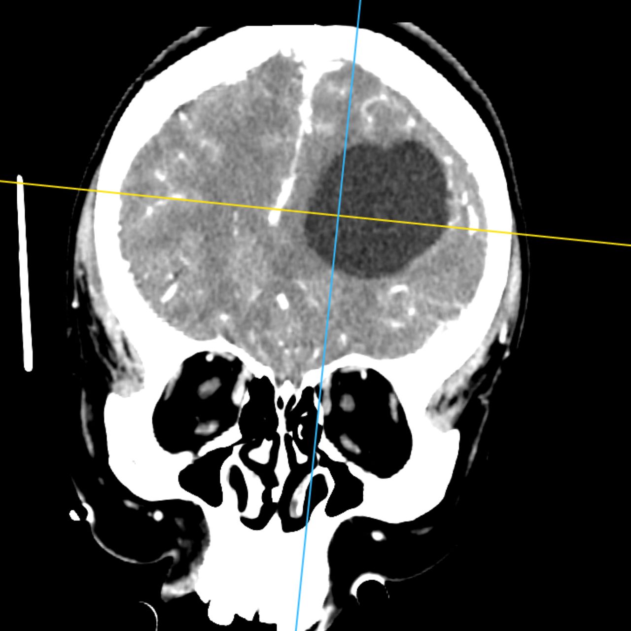 David Tafur Muñoz-2074