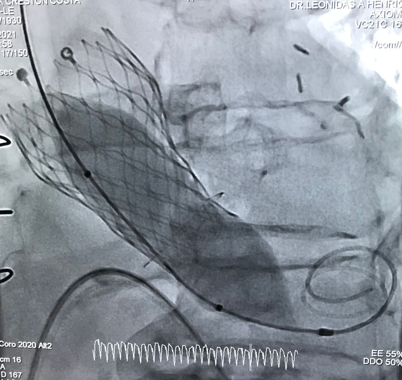 Leônidas Alvarenga Henriques-11