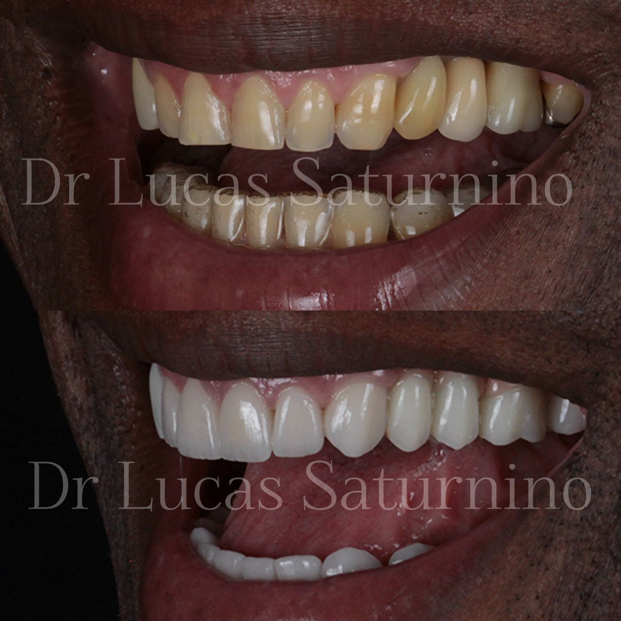 Lucas  Saturnino-6