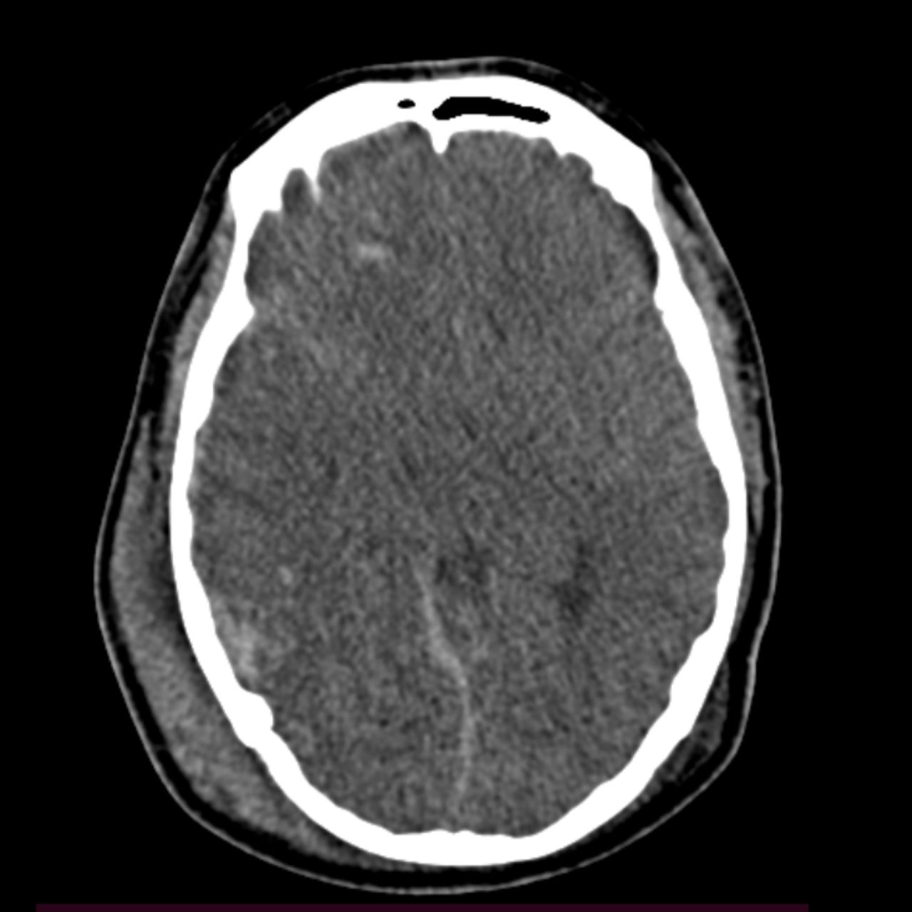 David Tafur Muñoz-2008