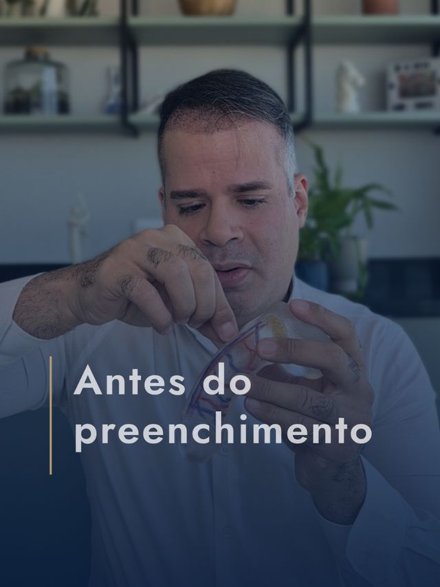 Marcelo Oliveira Nunes-27