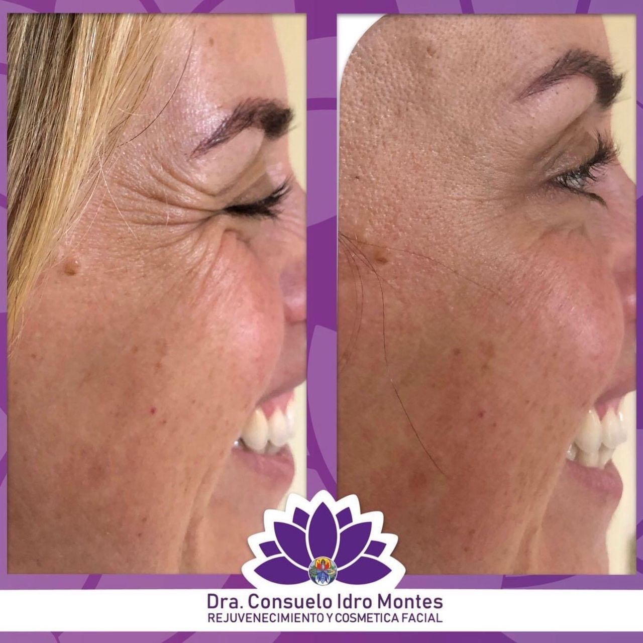 María Consuelo Idro Montes-3