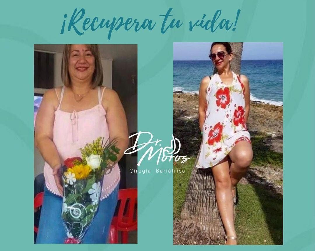 J. Gonzalo Moros I.-4