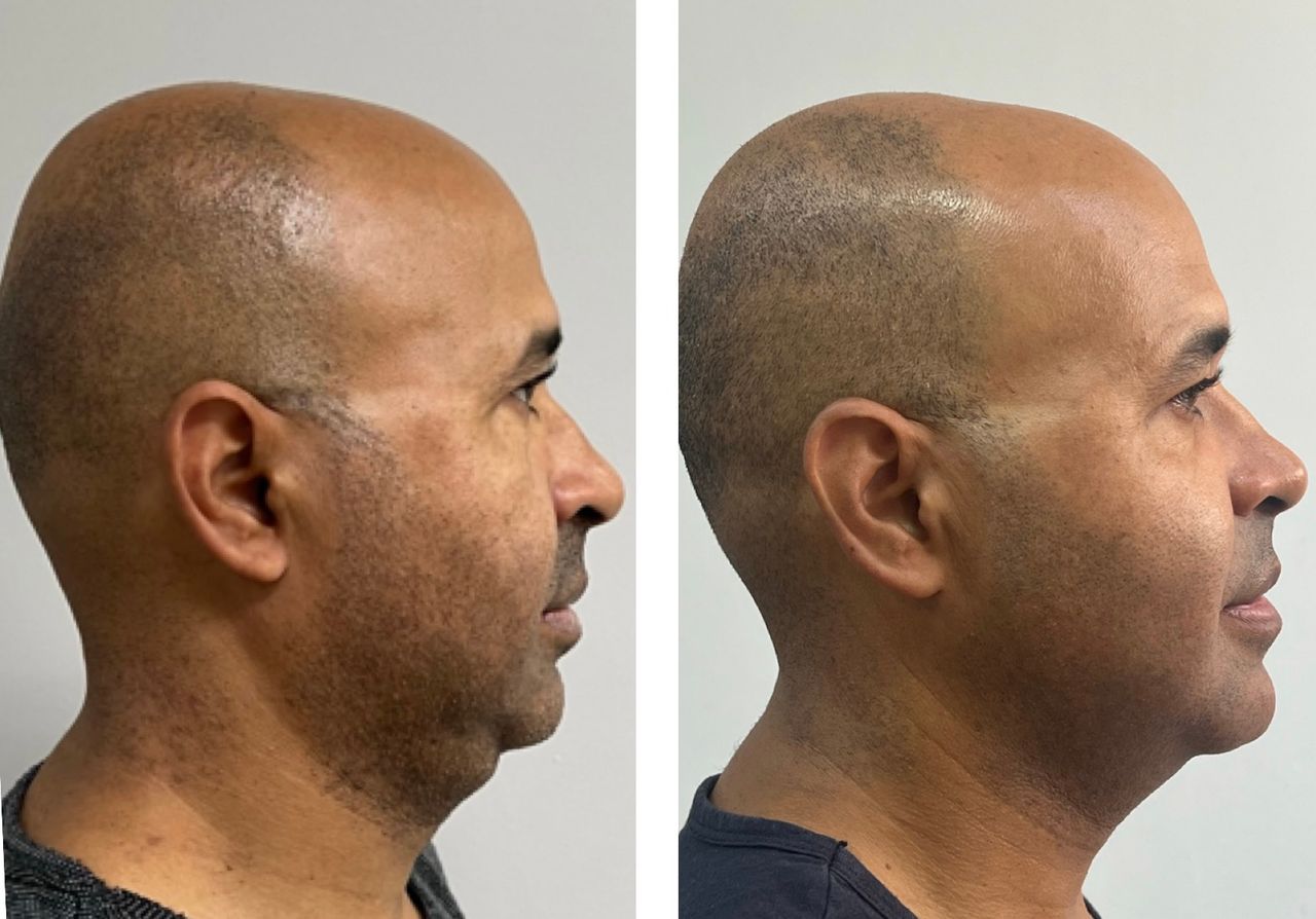 Daniel Assunção-11