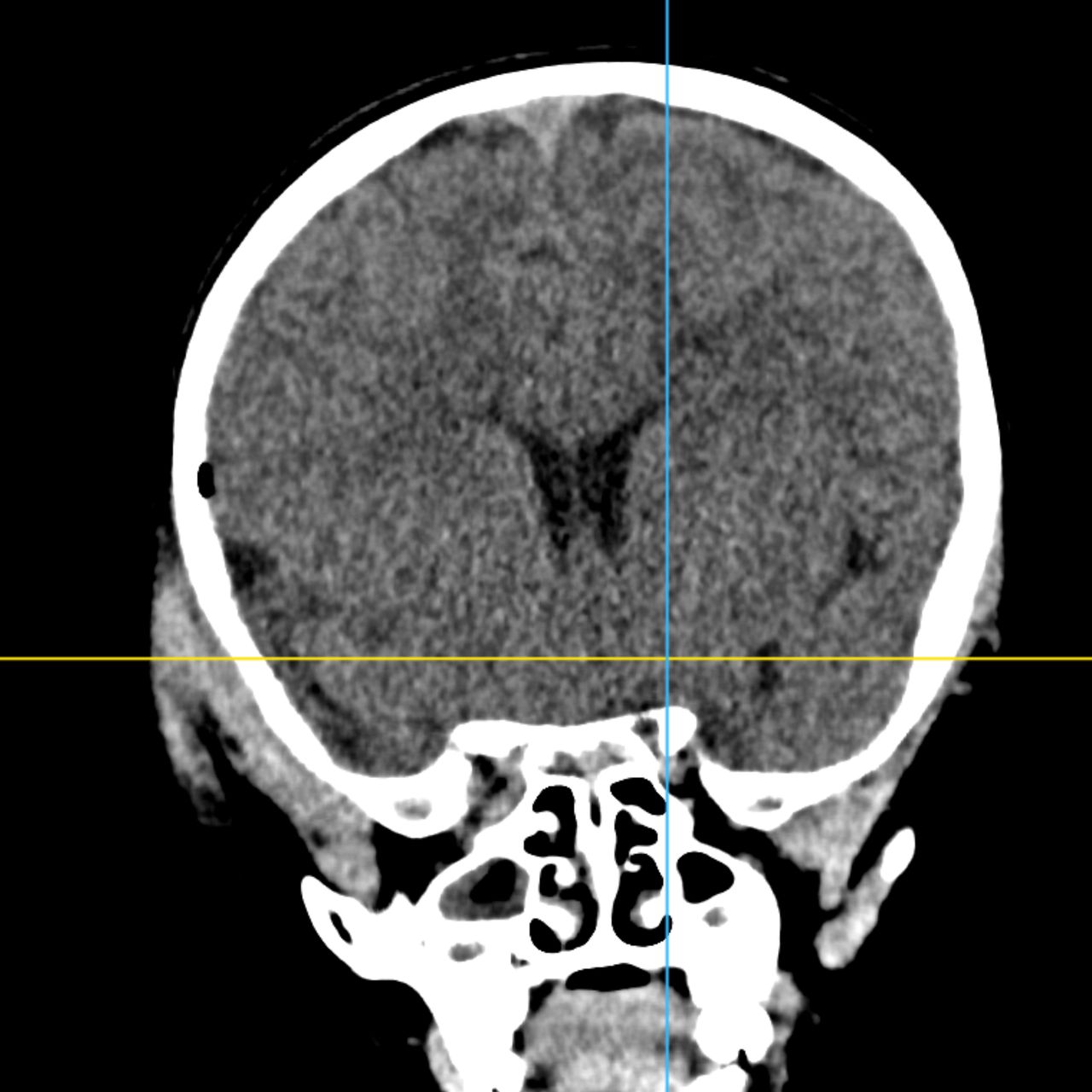 David Tafur Muñoz-1807