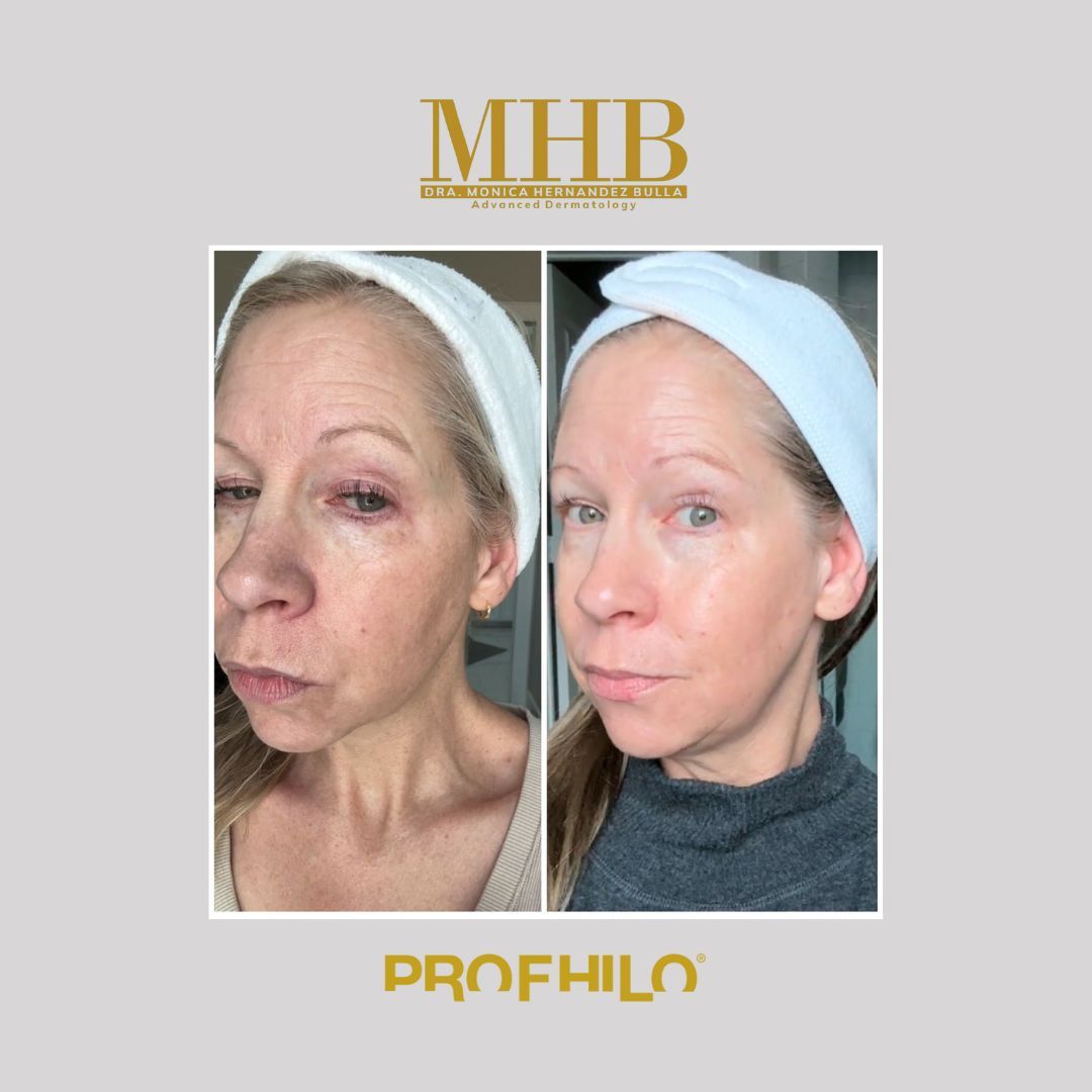 Mónica Hernandez Bulla-28