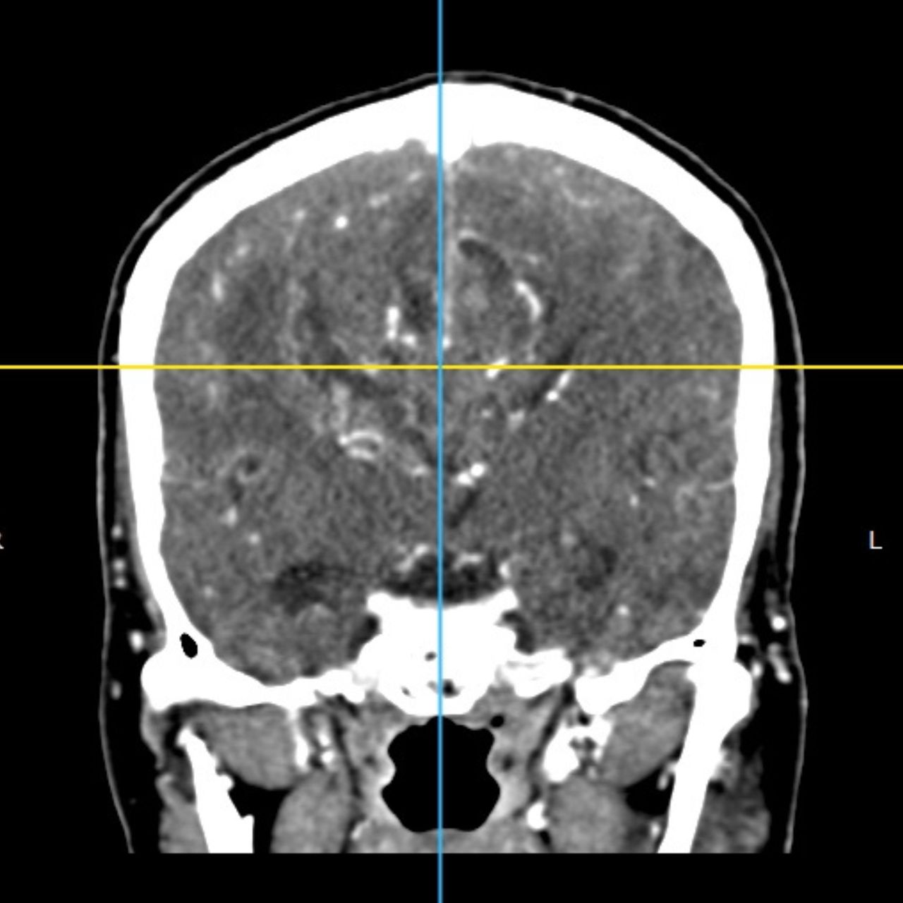 David Tafur Muñoz-1757