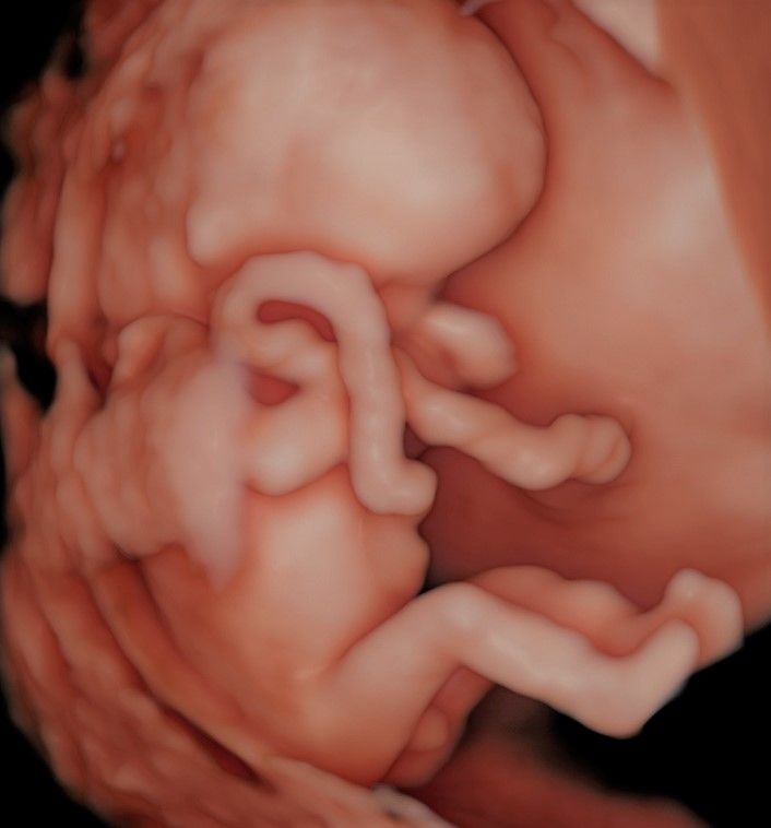 Charles Schwantz De Lima-18