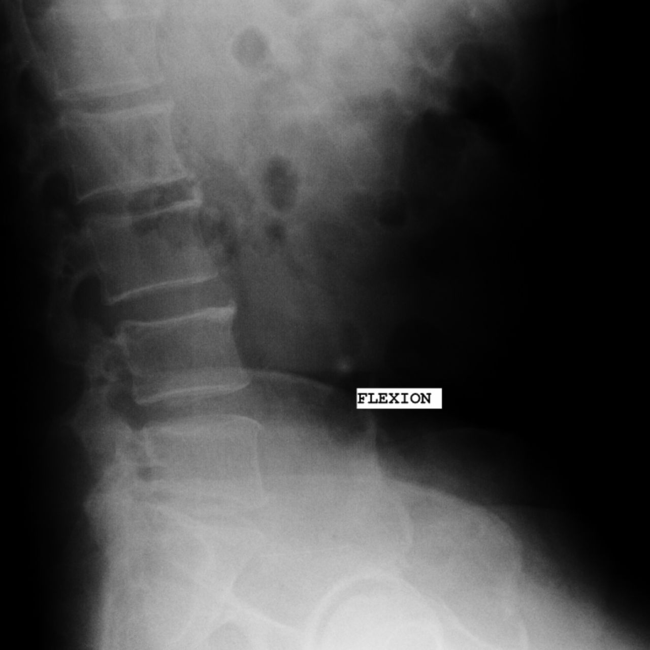 David Tafur Muñoz-1563