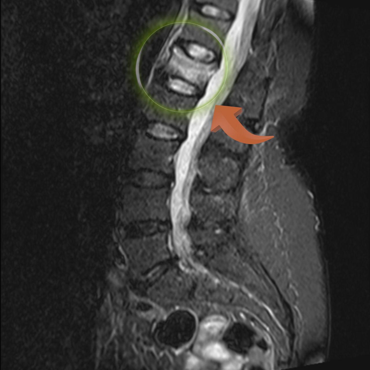 David Tafur Muñoz-1165