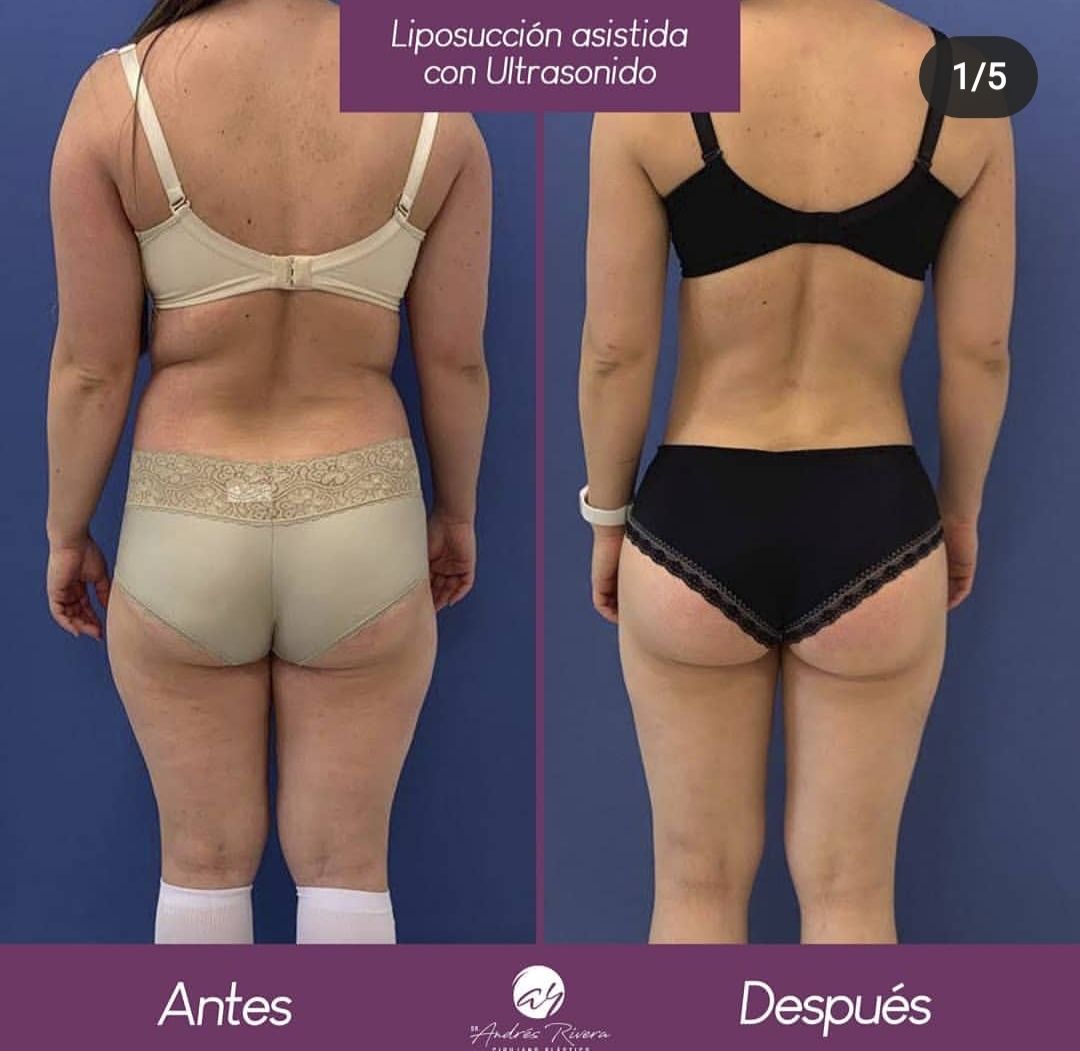 Andrés Rivera López-29