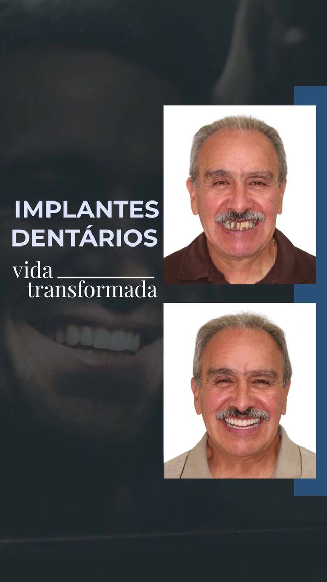 Gustavo Suassuna-34