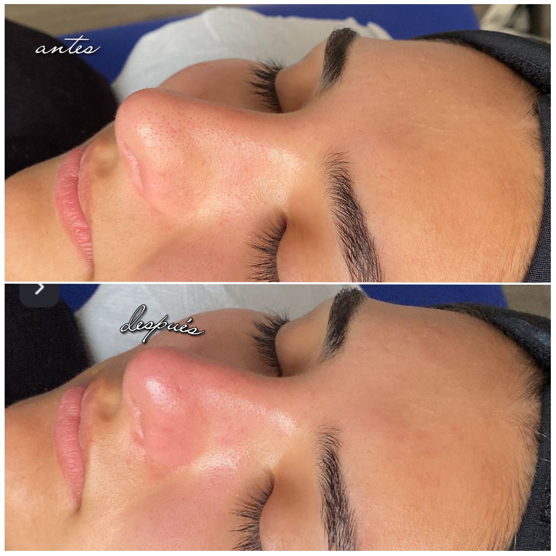 Scarlett Bartsch Ferrada-45