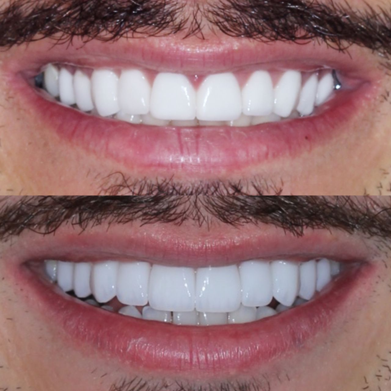 Caroline Benedeti-34