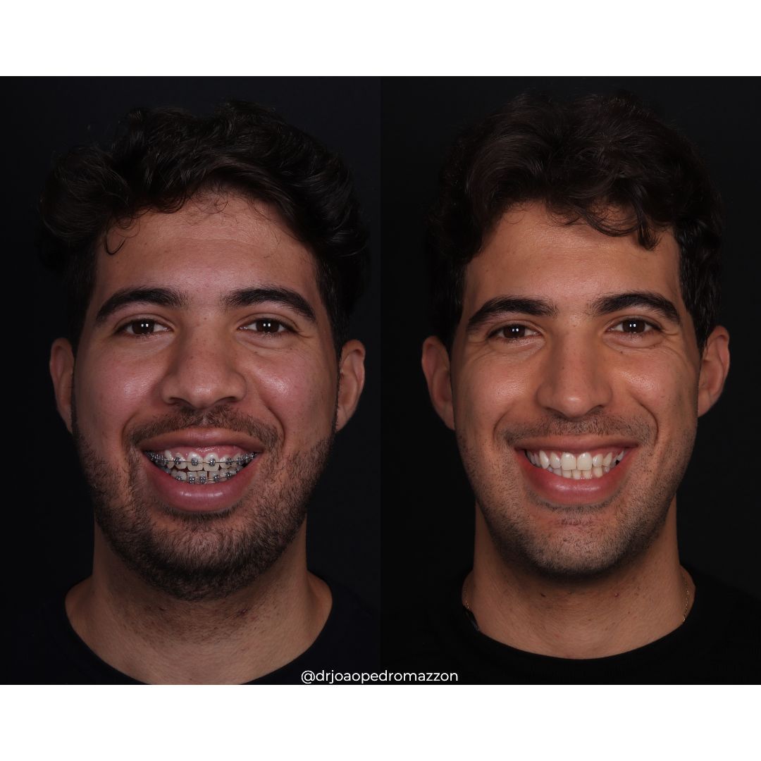 João Pedro Paulino Mazzon-43